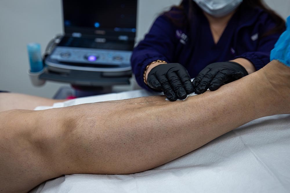 Knee Pain treatment preparation Bronx NY