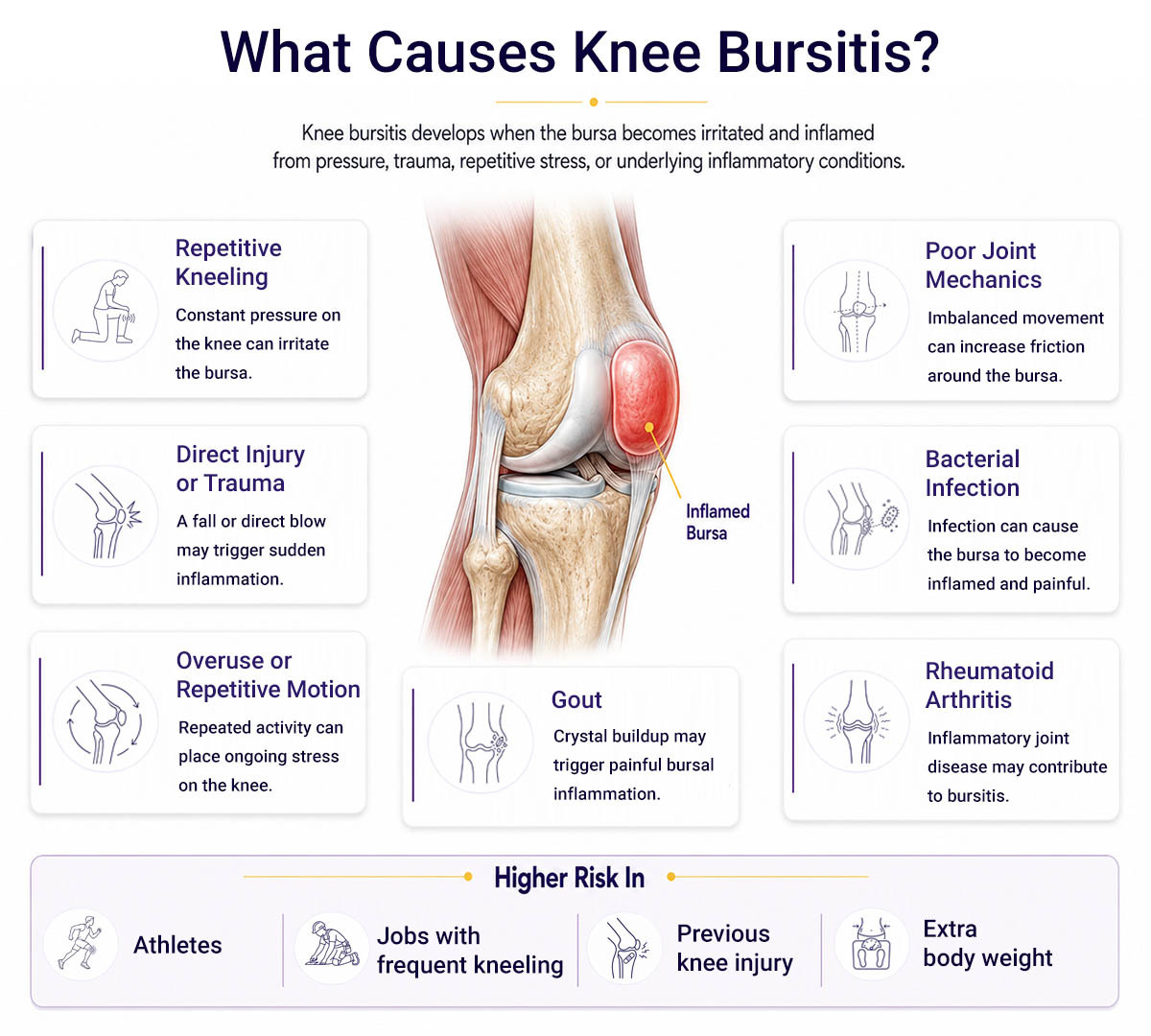 Knee Bursitis Causes Infographic in Brooklyn, NY