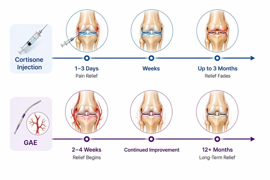 Medical timeline comparing GAE vs cortisone injection for knee pain relief duration, showing short-term steroid relief and longer-term GAE improvement.